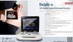  Ultrasound Scanner adopts advanced high-precision digital  beam former – fotka 2