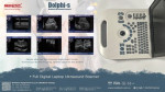  Ultrasound Scanner adopts advanced high-precision digital  beam former – fotka 3